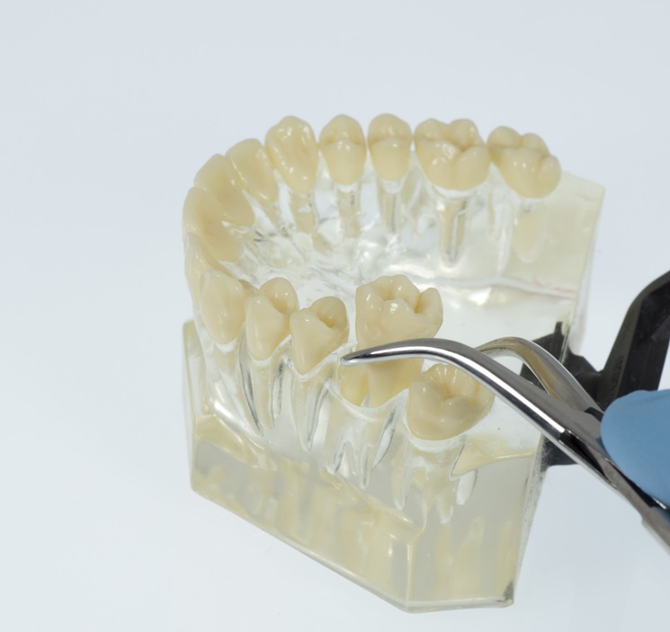 dental instrument holding a lower model of the jaw